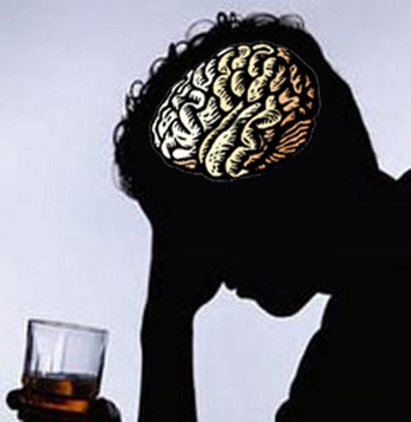 alcoholismocerebro
