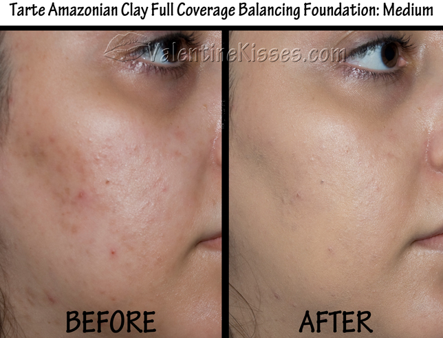 before and after foundation. My Before amp; After using this