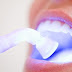 Cách khắc phục răng vàng ố 