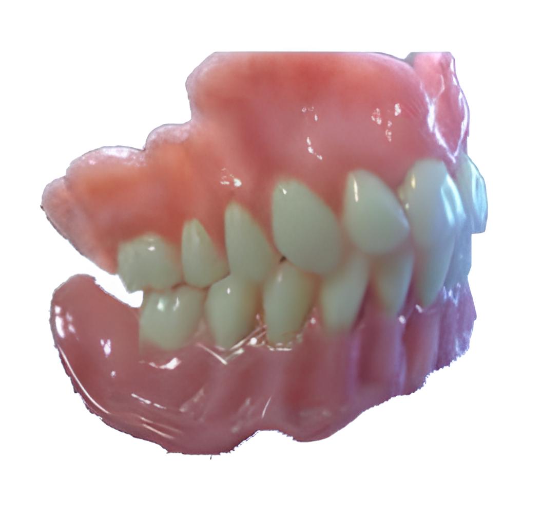 Acrylic-Full-Dentures-new-style%20(1).jpg