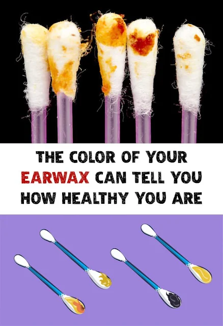 The Color And Texture Of Your Earwax Reveals Everything About Your Health! What Color Is Yours?