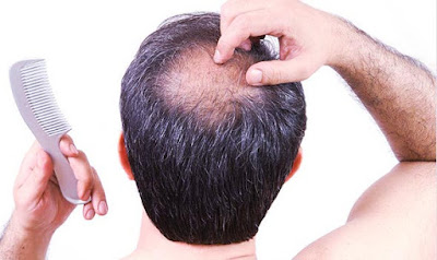 alternative treatments for hair growth