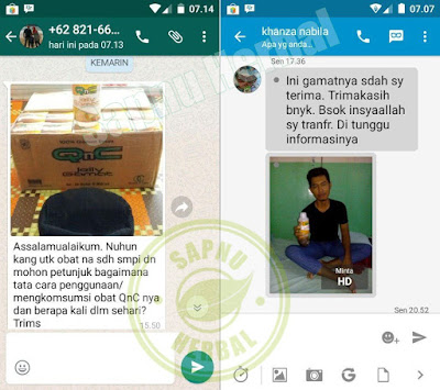 Cara Mengobati Prostat Bengkak Tanpa Operasi