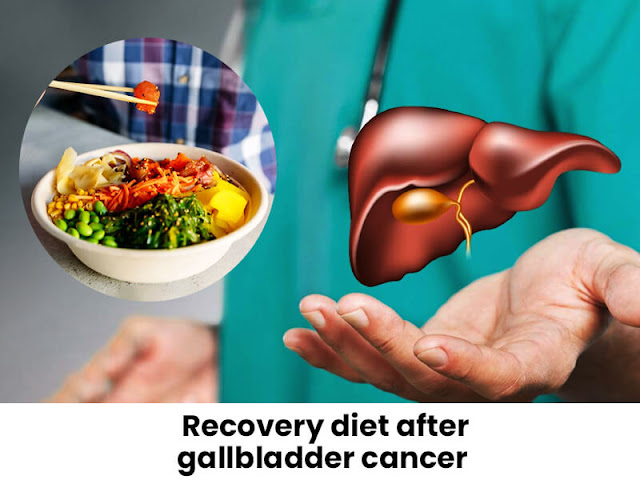 diet after gallbladder cancer treatment