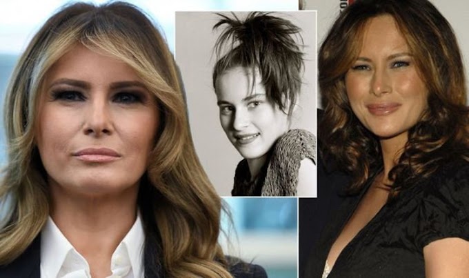  First Ladies and Plastic Surgery