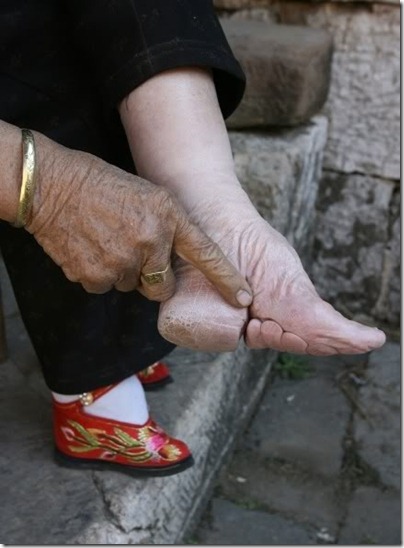 foot-binding