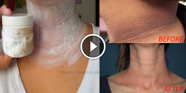Apply This And Eliminate Those Annoying Dark Spots On Your Neck, Armpits And Elbows