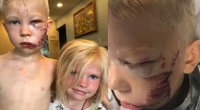 Bridger Walker, A 6-Year-Old Boy, Rescues his Sister from a Dog Attack