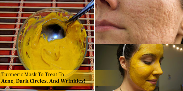 Turmeric Mask To Treat To Acne, Dark Circles, And Wrinkles!