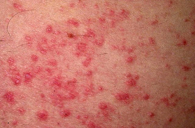 Penjelasan Lengkap Tentang Dermatologi