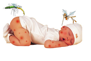 trị muỗi đốt cho trẻ