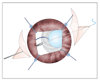 ophthalmology open access journals