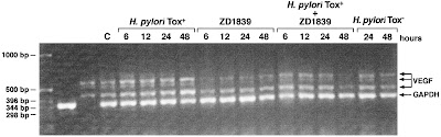 máy xét nghiệm tìm vi khuẩn hpylori bằng hơi thở