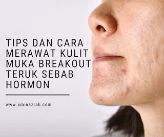 Tips dan Cara Merawat Kulit Muka Breakout Teruk Sebab Hormon