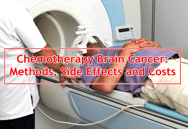 Chemotherapy Brain Cancer: Methods, Side Effects and Costs