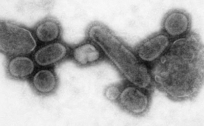 This negative stained Transmission Electron Micrograph showed recreated 1918 influenza virions that were collected from the supernatant of a 1918-infected Madin-Darby Canine Kidney (MDCK) cell culture 18 hours after infection. Image provided by Centers for Disease Control and Prevention's Public Health Image Library (PHIL), with identification number #8243, Photo credits belong to Cynthia Goldsmith, Content Providers(s): CDC/ Dr. Terrence Tumpey/ Cynthia Goldsmith