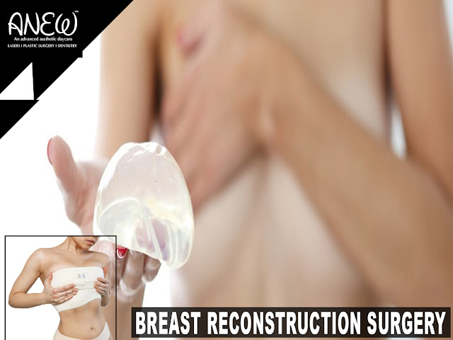 Breast Reconstruction Surgery in Bangalore