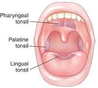 Macam-macam tonsil