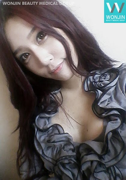 짱이뻐! - Looks Much Better After Korean Celebrities Breast Surgery