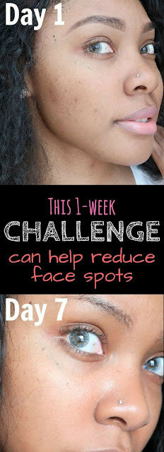The 1-week beauty challenge that can help to reduce face spots