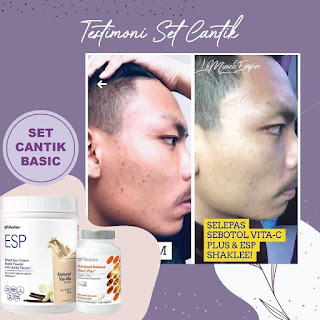 Set Cadangan Jerawat Shaklee untuk Kulit Jerawat Lelaki 4