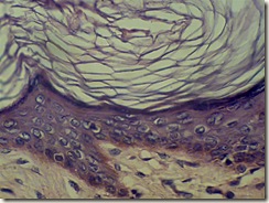 squamous karatinized histology microscope
