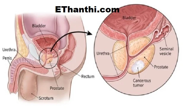 புரோஸ்டேட் சுரப்பி