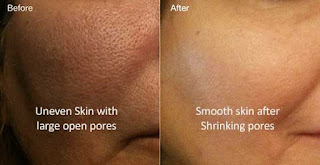 It conditions your skin and tightens open skin pores