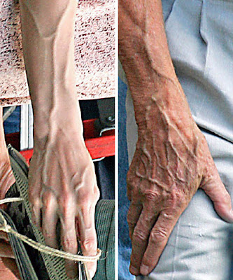 Frightening Angelina Jolie Vein Photos of The Day