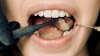 How to Improve Gum Health Naturally