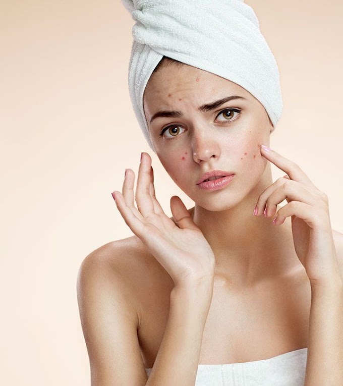  10 Essential Skin Care Tips for a Flawless Complexion