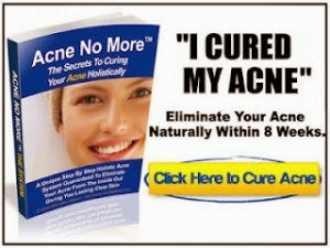 Acne Cure