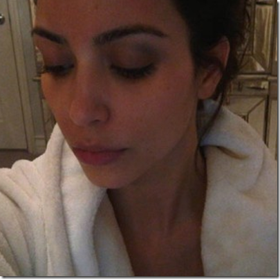 Kim Kardashian Black Eye