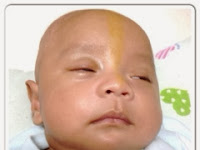 Cara Hilangkan Hidung Tersumbat Pada Bayi