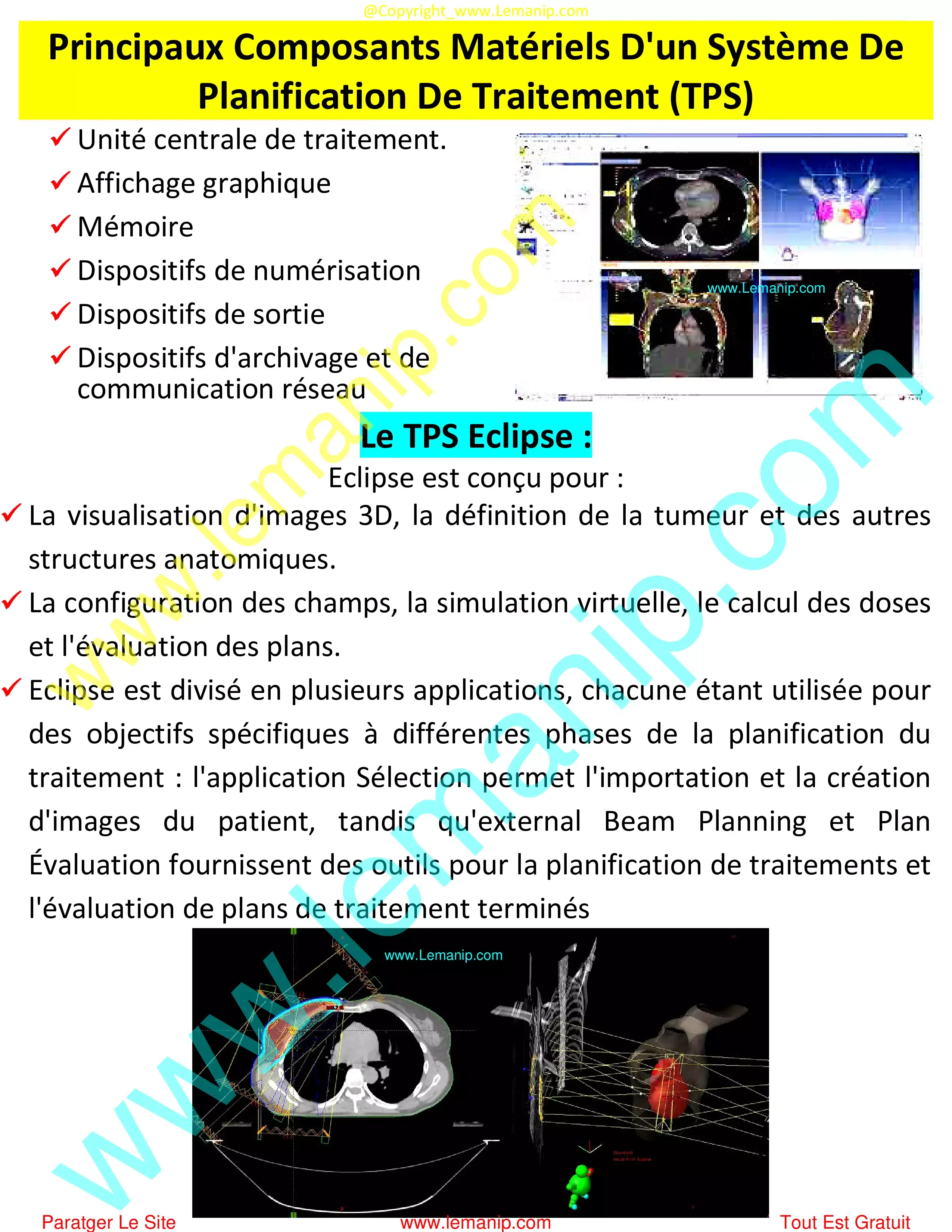 Principaux Composants Matériels D'un Système De Planification De Traitement (TPS)