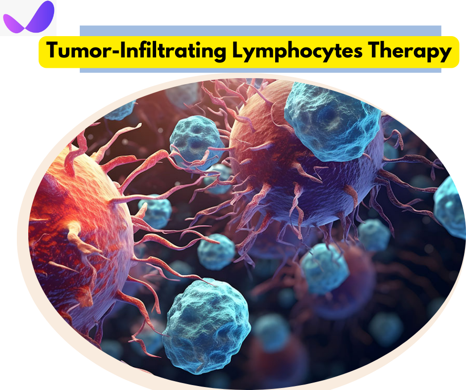 Tumor-Infiltrating Lymphocytes Therapy