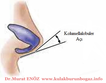 kolumella lobuler açı (kolumella-lobüler kırılma noktası / columella-lobular breakpoint