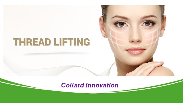 "Thread Lifting: A Minimally Invasive Solution for Youthful Skin"