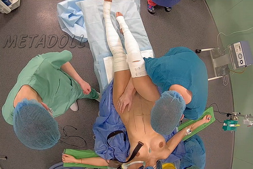 Hospital Secretly Filmed Women During Surgery (Women during operation 08)