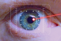 What is LASIK? Definiton and Overview of it.