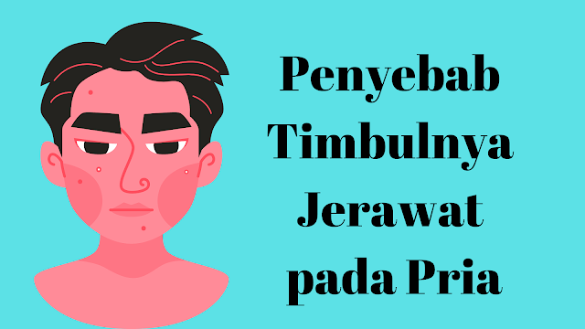 Penyebab Pria Berjerawat