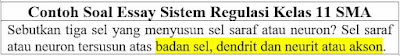 Contoh Soal Essay Sistem Regulasi Kelas 11 SMA dan Jawabannya