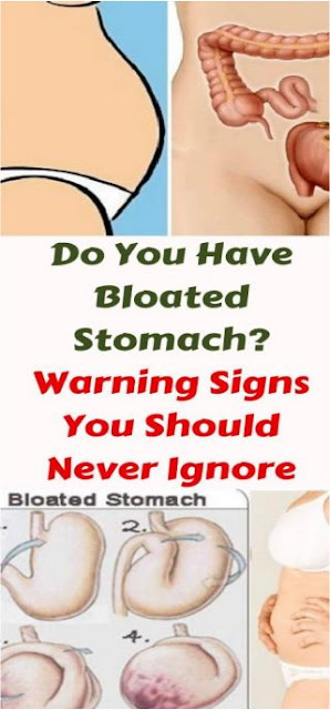 Always Have A Bloated Stomach? Never Ignore These Warning Signs!