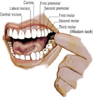 7 Obat sakit gigi tradisional yang paling ampuh