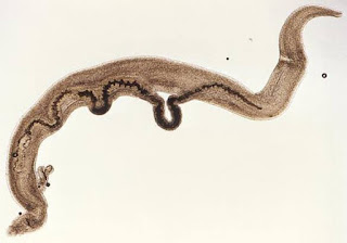 Schistosoma mansoni