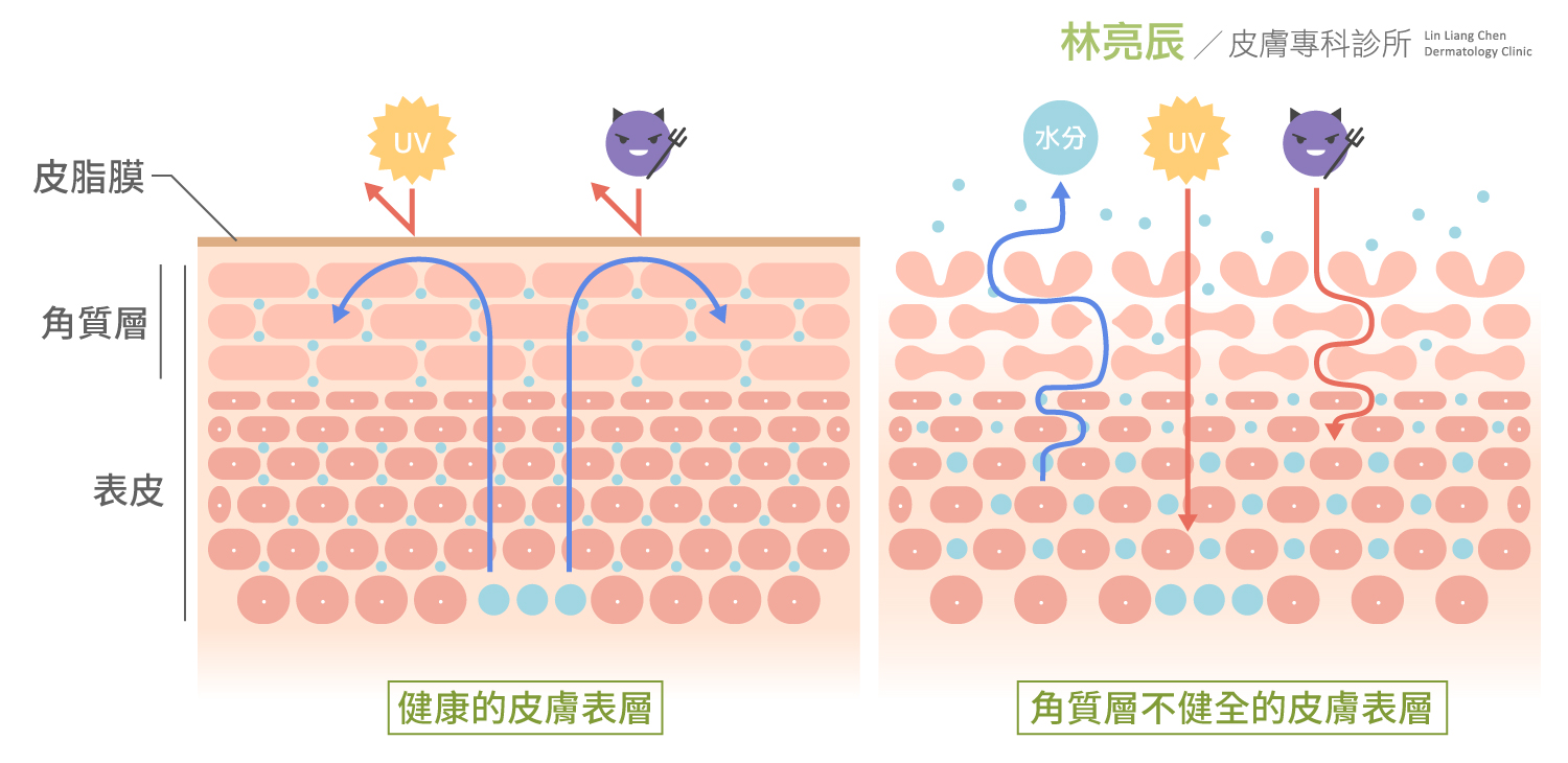 敏感肌 皮膚科醫師診間真心話3個自找敏感肌的ng保養行為原來是這個 林亮辰皮膚專科診所 敏感肌 皮膚科醫師診間真心話3個自找敏感肌的ng保養行為原來是這個 林亮辰皮膚專科診所