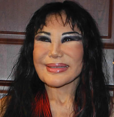 Nicki Minaj Before And After Surgery Photos. Burt Reynolds before and after