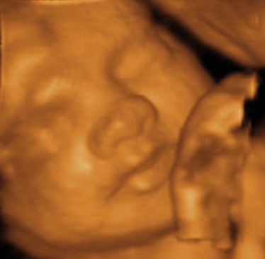 3d Ultrasound Baby7