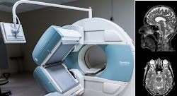  Οι Κινέζοι επιστήμονες δημιουργούν μια μηχανή ανιχνευτής  απεικόνισης μαγνητικού συντονισμού (MRI), που κοστίζει πάνω από 126 εκατομμύρια δ...