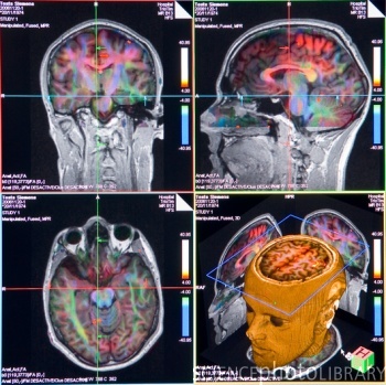 Brain Imaging8